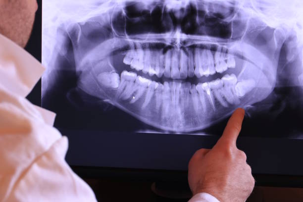 Dentist for Dental Trauma in GA